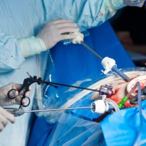 Different Types of Surgical Trocars